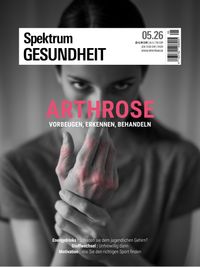 Spektrum Gesundheit 5/2026 - Arthrose
