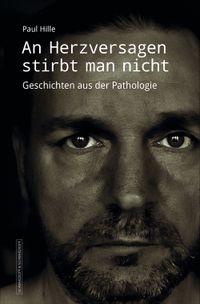 An Herzversagen stirbt man nicht