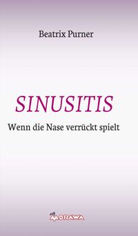 SINUSITIS